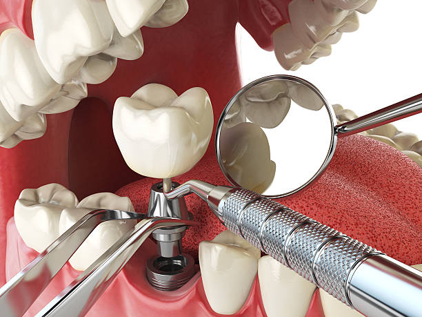 Best Urgent Dental Care for Toothache in Sidney, IL